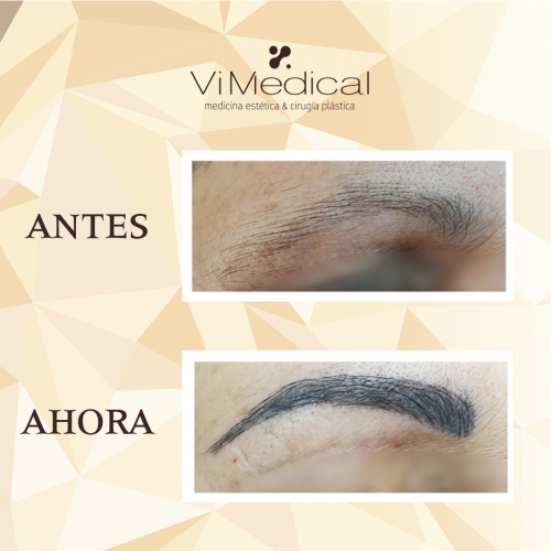 Micropogmentaci�n Cejas
